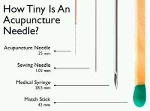 acupuncture-needle-comparisons
